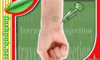 Injection Experience