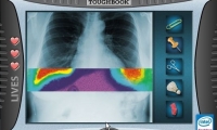 Crazy CAT Scan
