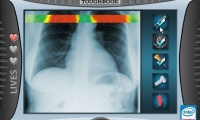 Crazy CAT Scan