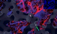 Membrane Massacre