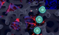 Membrane Massacre