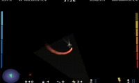 Retrofire