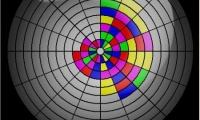 Unwind Logic Puzzle