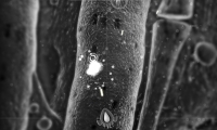 Nanozoa