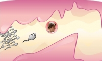 Baby Mama-Destination Insemination